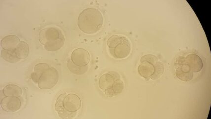 “عمليات ناجحة” للمركز التخصصي الأول من نوعه لمعالجة العقم في الدانا