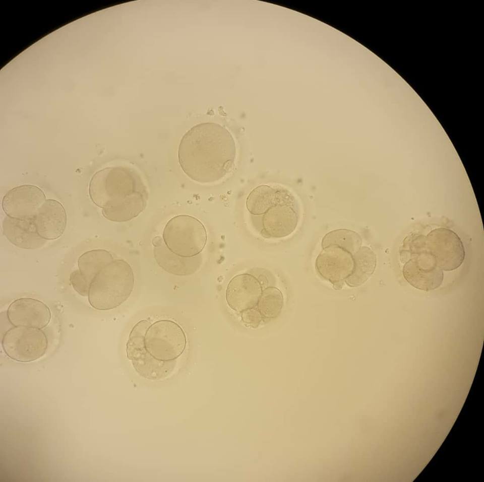 الصورة لأجنة بعمر 48 ساعة لإحدى مريضات المركز التخصصي لعلاج العقم والإخصاب المساعد في الدانا - المصدر: صفحة المركز على الفيس بوك.