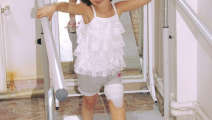 “خطوات الإرادة” مركز للأطراف الصناعية في مدينة الباب