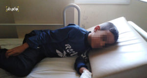 طفل مصاب بالتهاب الكبد في مشفى "هاند إن هاند" في أطمه بريف إدلب