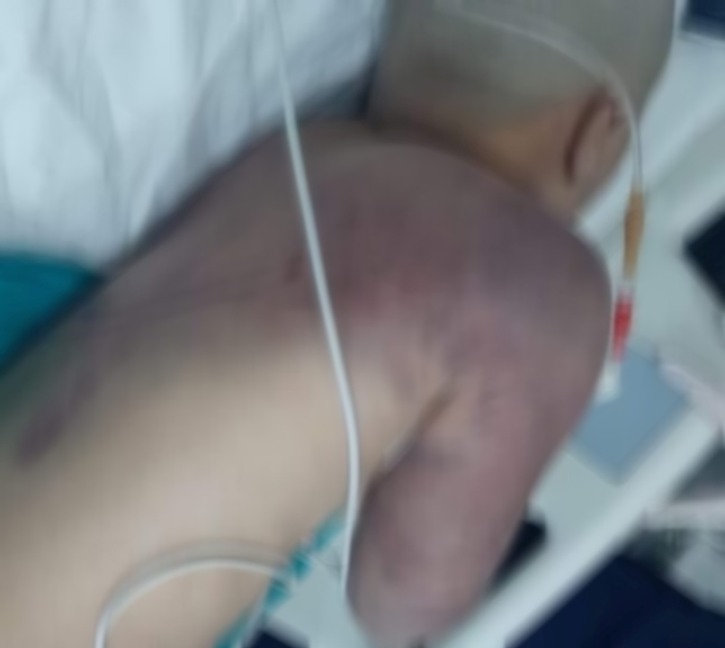 الطلفة رهف التي تعرضت لـ العنف الأسري من قبل والدها في إدلب -إنترنت