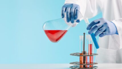 المخابر الطبية في حلب.. استثمار وسمسرة ومواد بجودة رديئة