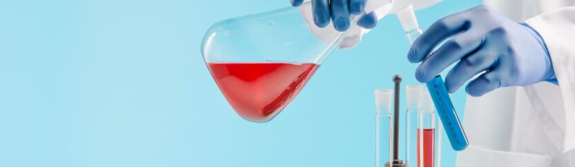 المخابر الطبية في حلب.. استثمار وسمسرة ومواد بجودة رديئة