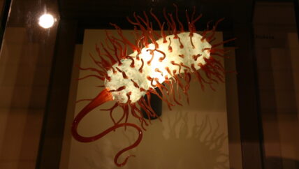 الكوليرا تنتشر في سوريا وحلب في مقدمة الإصابات والوفيات