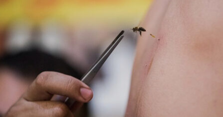 أبو حبيب.. رحلة طبابة شعبية في دير الزور