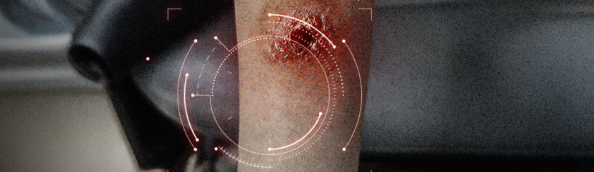 على طرقات ريف إدلب الجنوبي.. معركة يومية للحد من انتشار اللشمانيا