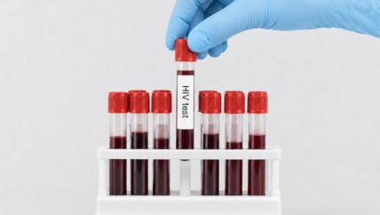 الخوف.. رحلة المتعايشين مع فيروس الإيدز في سوريا